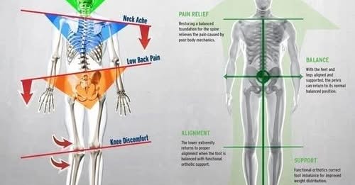 Osteoarthritis Knee biomechanics