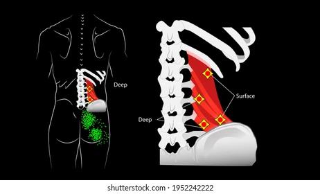 Living with the Pain