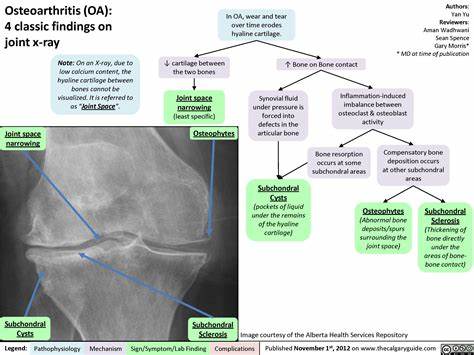 Osteoarthritis knee