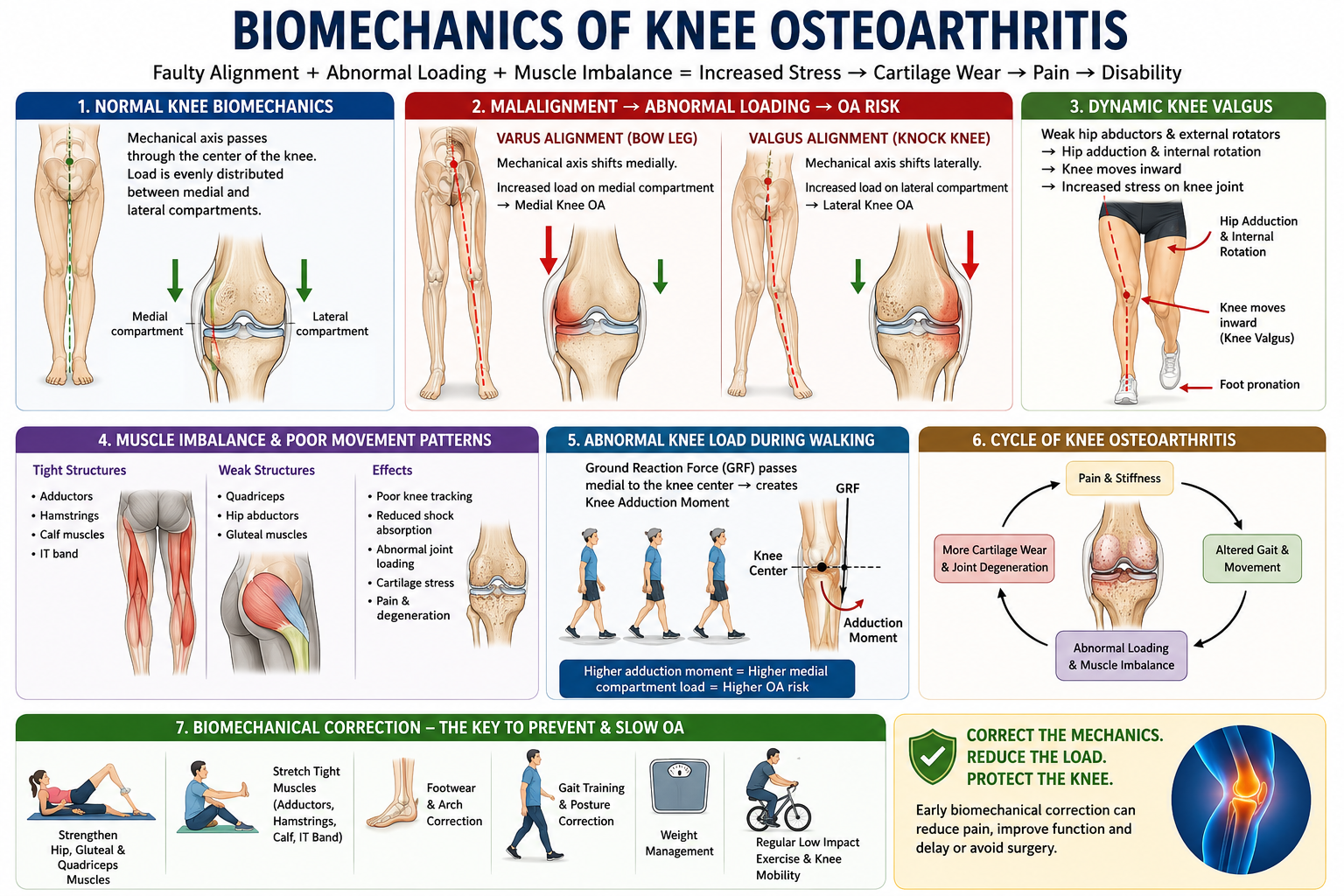 Biomechanics of Knee Osteoarthritis