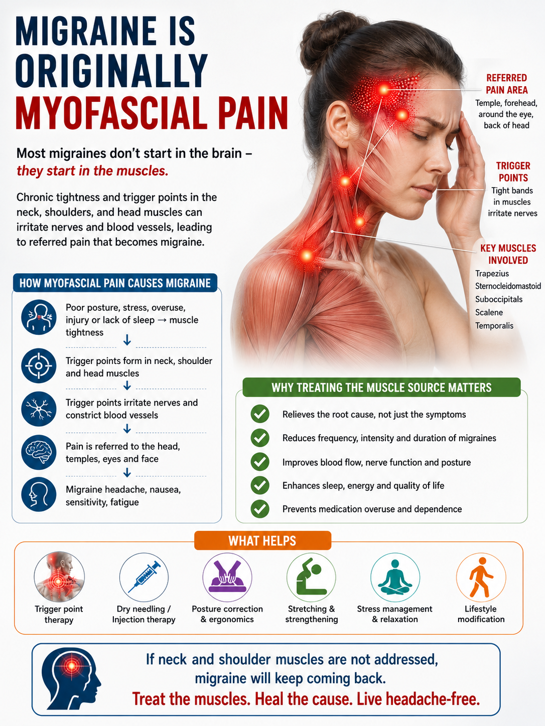 Migraine is originally myofascial pain