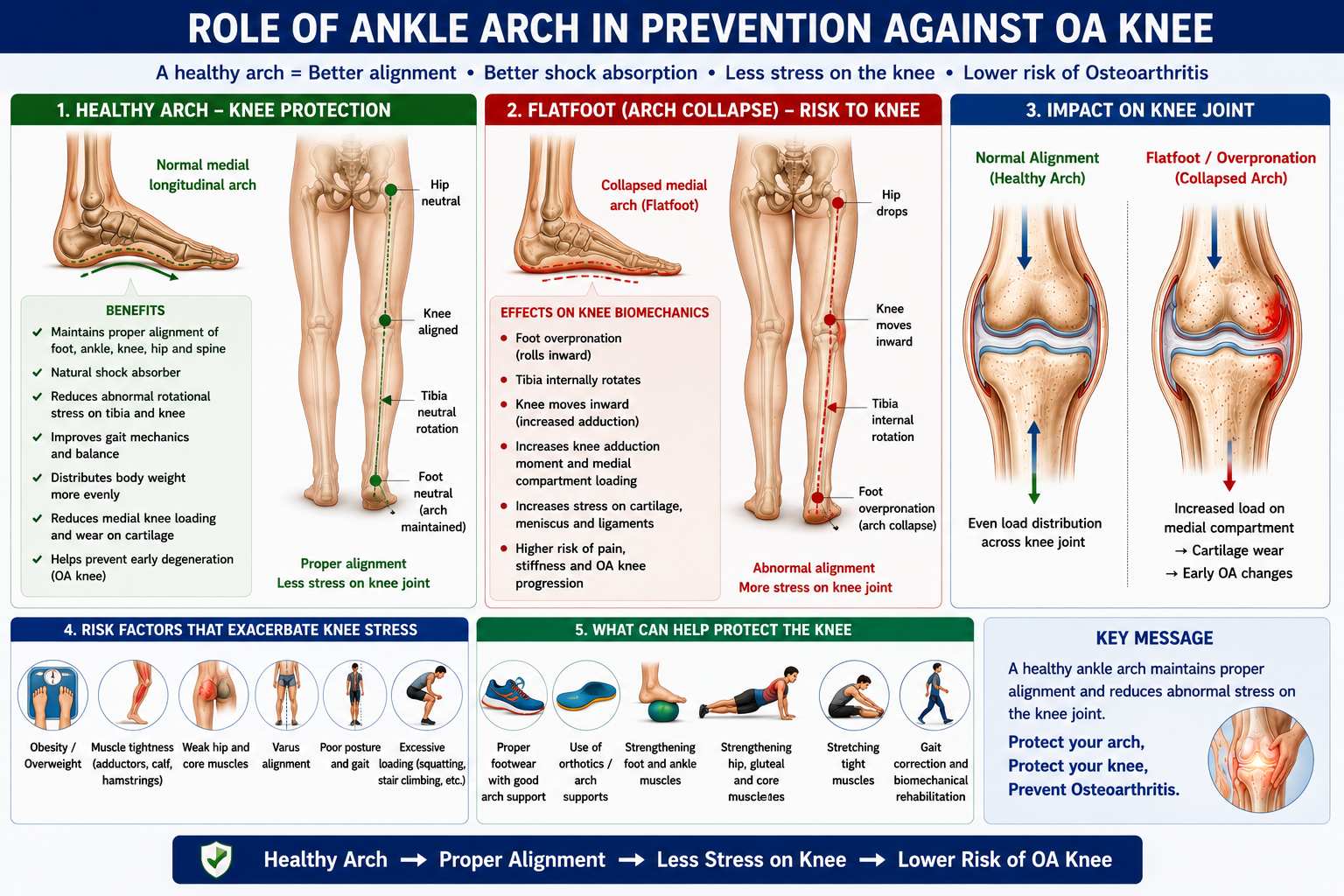 Foot Arch and Osteoarthritis Knee