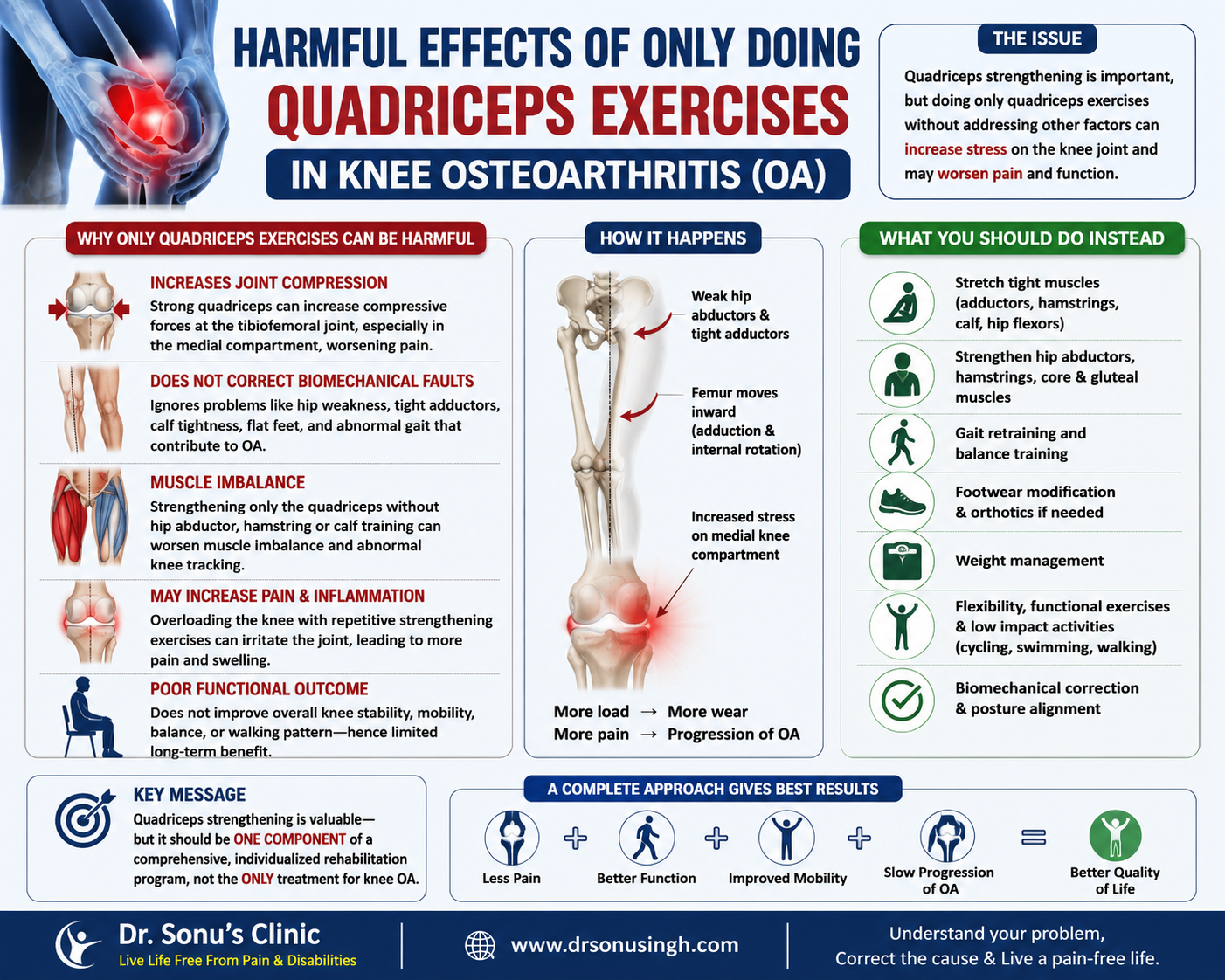 Harmful Effects of Only Doing Quadriceps Exercises in Knee Osteoarthritis