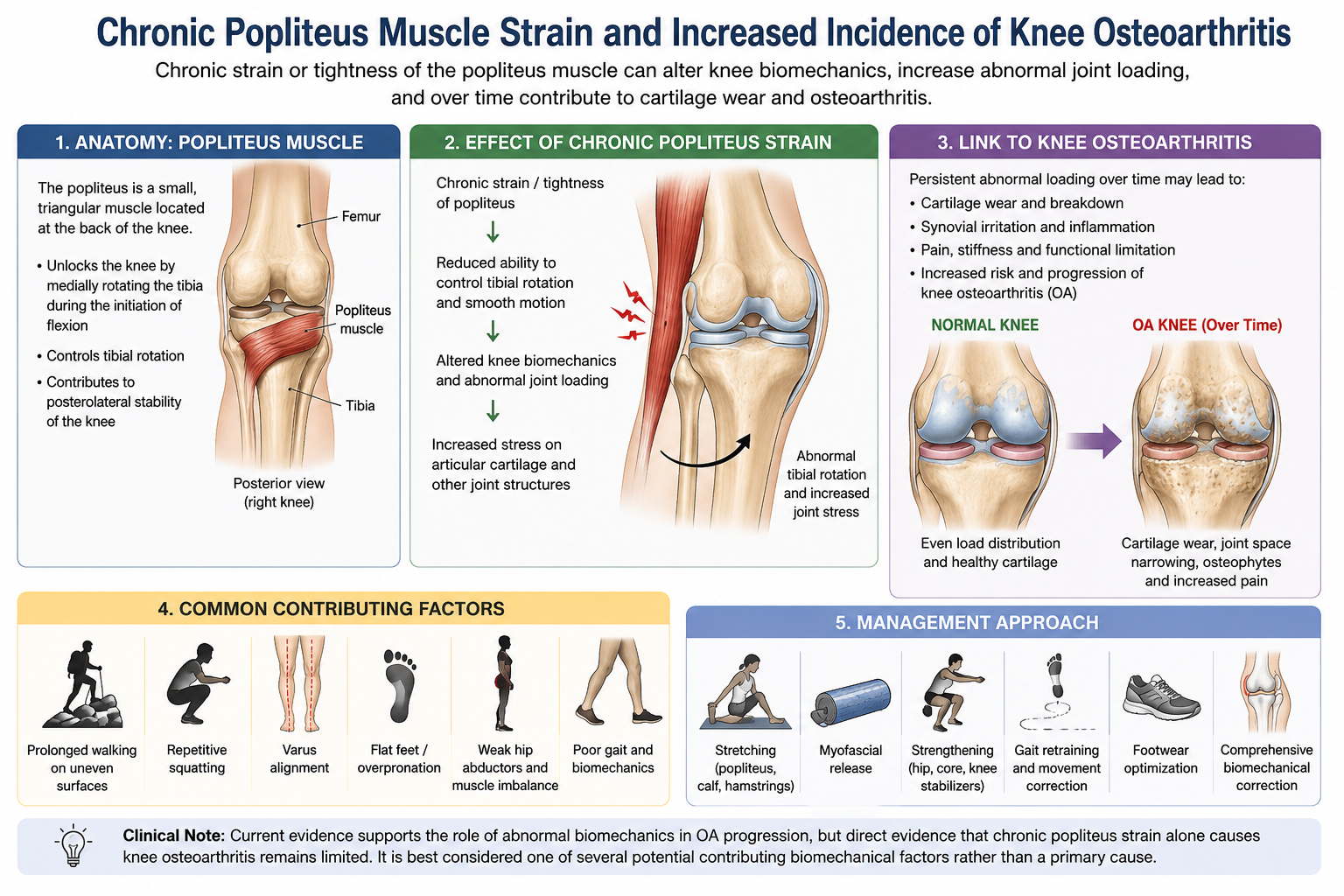 Chronic Popliteus Muscle Strain and Increased Incidence of Knee Osteoarthritis (OA)